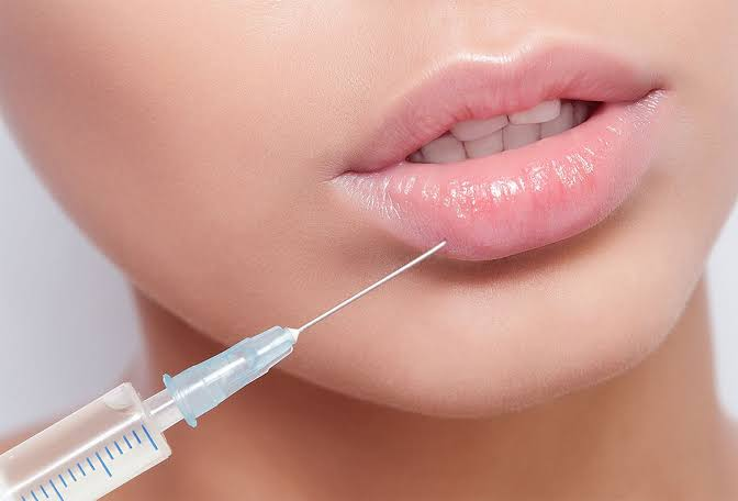 Planning a Lip Filler Consultation Near Walnut Creek Planning a Lip Filler Consultation Near Walnut Creek